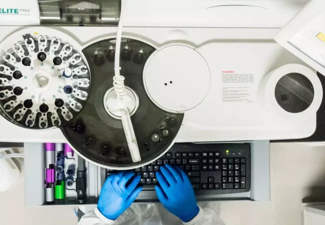 Top-down view of an automated laboratory analyzer operated by a scientist in blue gloves, used for animal disease models and biomarker studies in immunology.