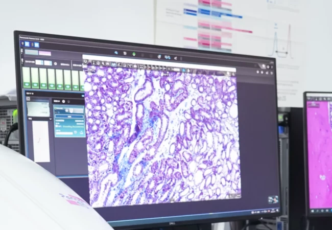 Close-up of a computer monitor displaying detailed tissue sample imagery for inflammation and pain animal models in research.