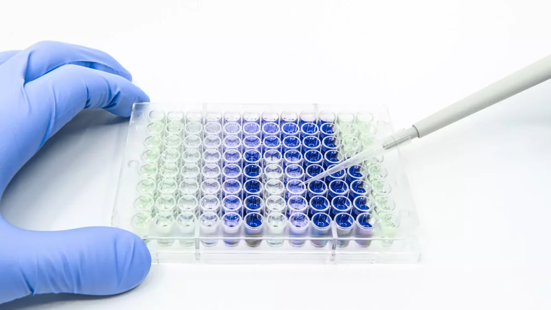 Scientist is holding 96 well micro plate for ELISA immunoassay with pipettesScientist is putting reagents into 96 well micro plate including diluted proteins and sample with a single channel pipette for biological experiment