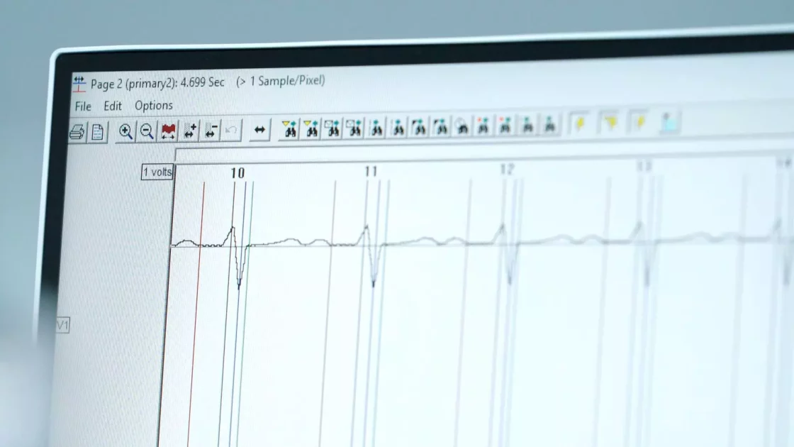 Computer screen displaying ECG waveforms from safety pharmacology core battery studies, monitoring cardiac electrical activity for drug safety evaluation.